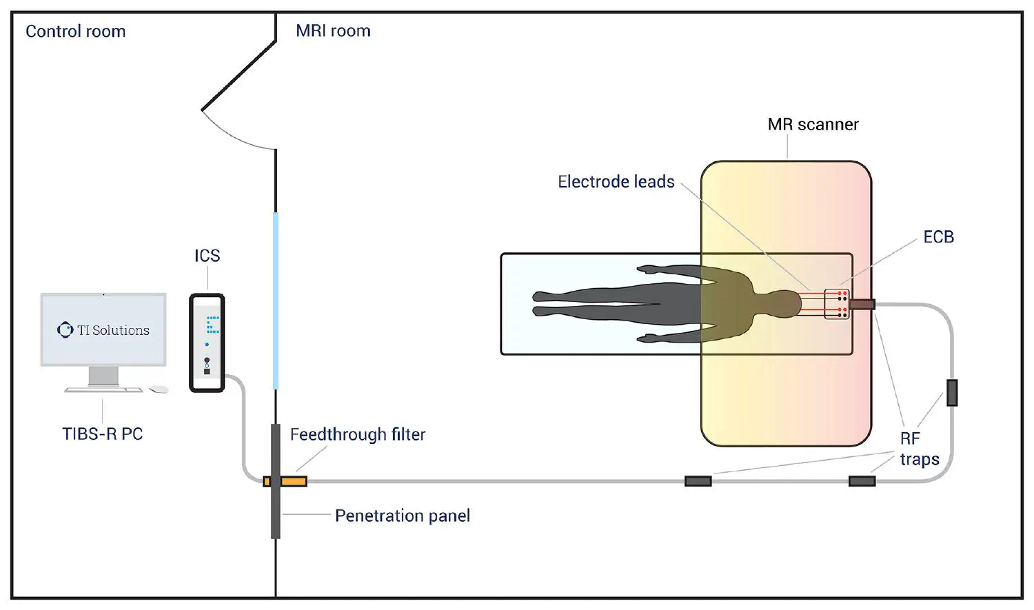 MRI-Room-with-TI-Solutions-devices-V8-1920px.jpg